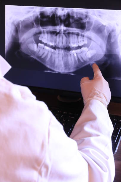 Best Emergency Tooth Extraction in Glendale, MS